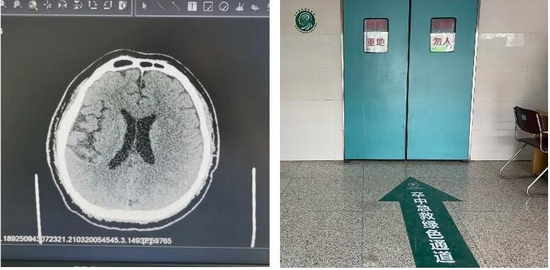 成都双楠医院卒中绿色通道，为生命保驾护航!