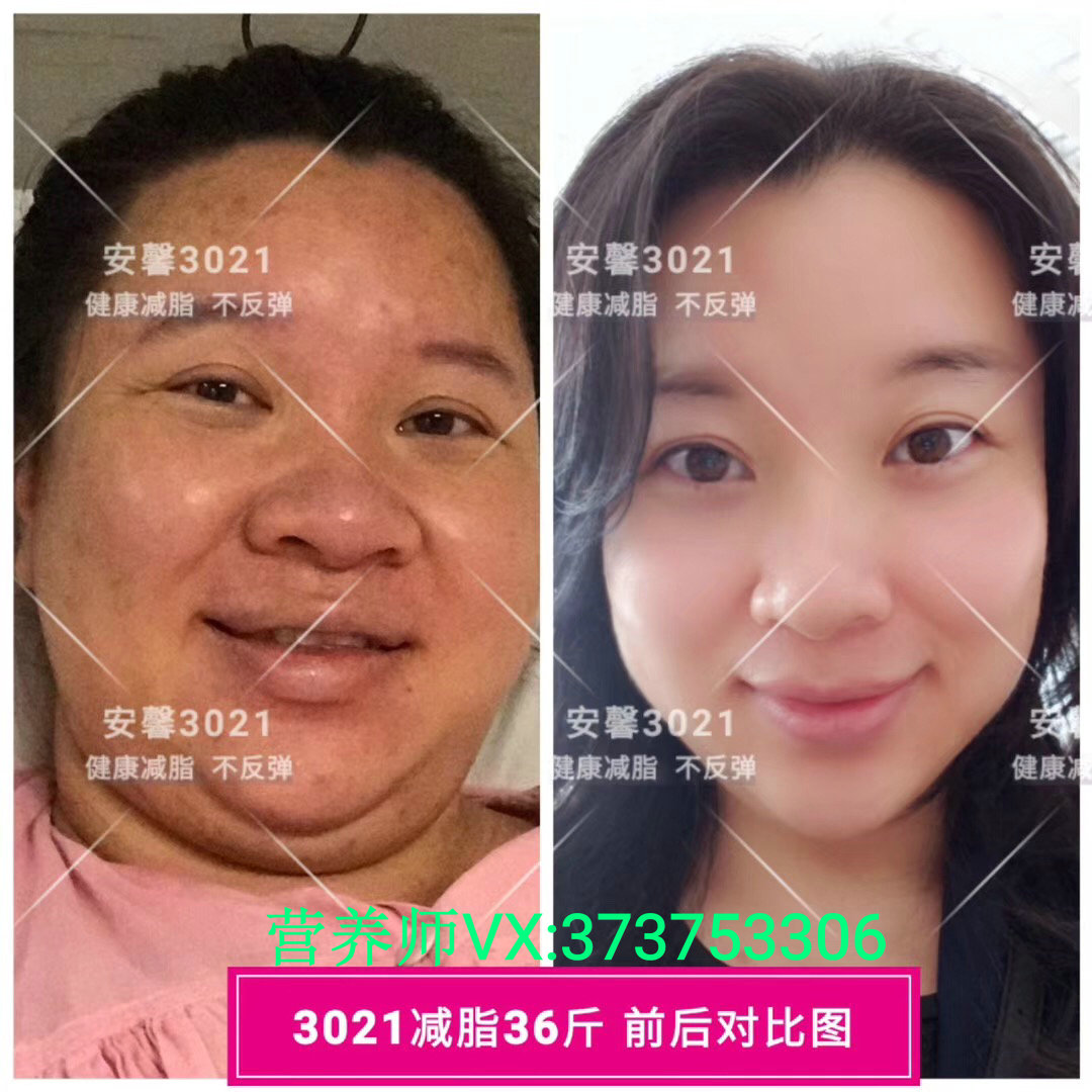 安馨董事肖济佳告诉你为什么安馨3021能瘦身还能美白？