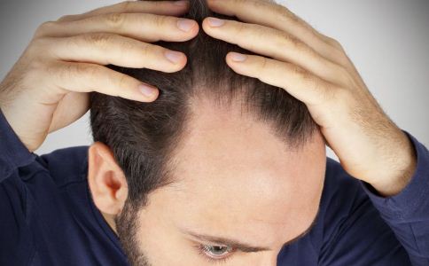 男性经常脱发什么原因 男人脱发怎么办 男人脱发如何护理