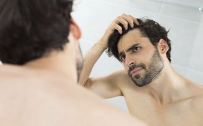 男性脱发什么原因 脱发怎么治疗 吃什么食物有助治疗